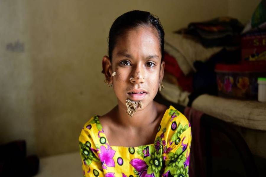 مراحل تشخیص بیماری درختی